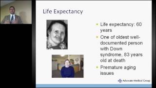 Down syndrome and Alzheimers Disease [upl. by Siuqramed]