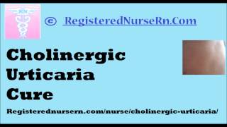 Cholinergic Urticaria Cure [upl. by Uot601]