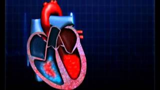 Atrial Septal Defect [upl. by Pass]