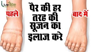 पैर में आई हर तरह की सूजन का इलाज  Home Remedies For Swelling PregnancyTravelling Allergy [upl. by Nathanial23]