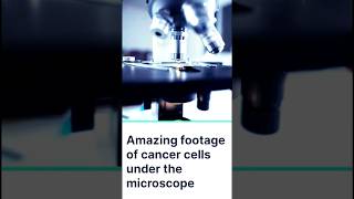 Cancer Cells Under Microscope microscope shorts cells [upl. by Mook]