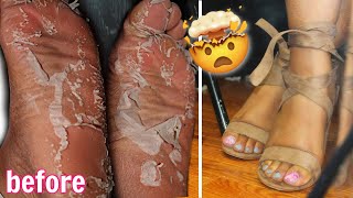 I TESTED A CRAZY FOOT PEEL MASK from AMAZON  Dominique Denésha [upl. by Adnana160]