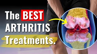 Knee Arthritis Treatments Proven to Work  The Truth You Need to Know [upl. by Halian382]