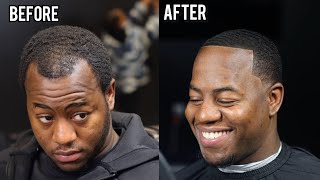 HOW TO FIX A RECEDING HAIRLINE [upl. by Vastha]