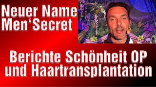 Frank Haartransplantation jetzt MenSecrets Youtube Kanal Schönheitsoperation Mann und Frau [upl. by Lledrac]