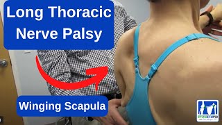 Long Thoracic Nerve Palsy Winging Scapula [upl. by Male]