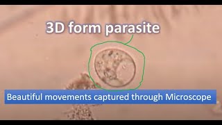 Motile trophozoite of Trichomonas under the Microscope [upl. by Hurd967]