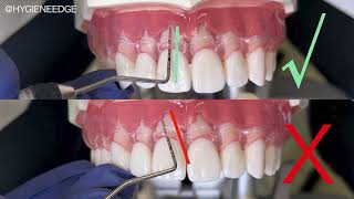 All Things Periodontal Probing with Kilgore International [upl. by Nyrol720]