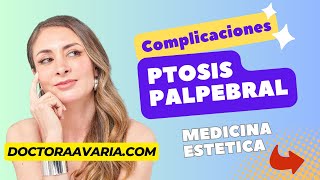 Complicaciones por Toxina Botulínica Ptosis Palpebral o Caída del Párpado [upl. by Alilad]