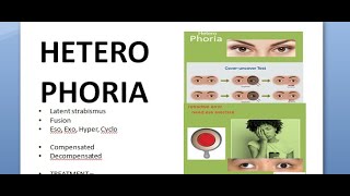 Ophthalmology 357 HeteroPhoria Latent Strabismus Squint Compensation DeCompensation [upl. by Zellner]