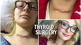 MY THYROID REMOVAL SURGERY  UPDATE [upl. by Apollo568]