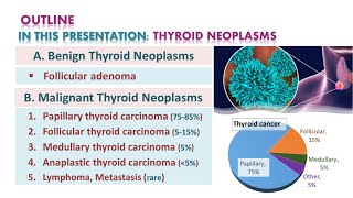 Thyroid neoplasmsTumors  شرح محاضرة [upl. by Romo191]