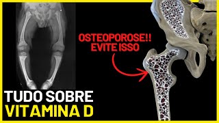 🔴👉 Vitamina D O SEGREDO do Sol para Ossos Fortes e Imunidade Alta Evite OSTEOPOROSE e FRATURAS [upl. by Aek509]