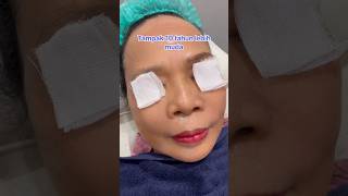 Treatment balik muda Collagen stimulator Aespella collagenstimulator skinbooster fypシ゚viral [upl. by Paik864]