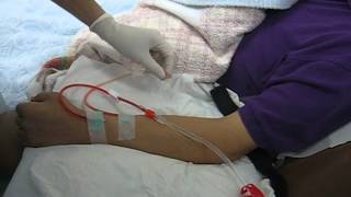 how to connect the patient to haemodialysis machine [upl. by Aihsaei443]