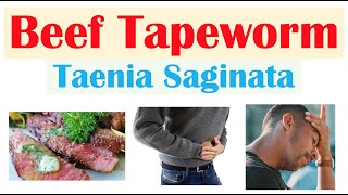 Beef Tapeworm Taeniasis  How It Infects Signs amp Symptoms Diagnosis Treatment Prevention [upl. by Dacie450]