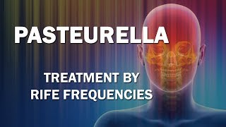 Pasteurella  RIFE Frequencies Treatment  Energy amp Quantum Medicine with Bioresonance [upl. by Nerha]