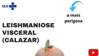 Leishmaniose Visceral calazar  características gerais sintomas e prevenção [upl. by Enitsud]