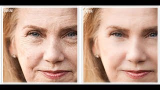 BEST ANTIAGING CREAM  AFFORDABLE  Revitol AntiAging Cream [upl. by Nnylamme905]