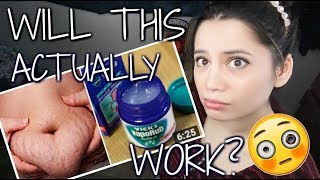 Vicks Vapor Rub For Weightloss  Can Vicks Vapor Rub Melt Belly Fat [upl. by Eedolem415]