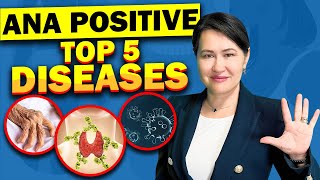 Top 5 Diseases with A Positive ANA Antinuclear Antibodies Test [upl. by Navoj]