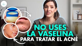 🔴 VASELINA en la CARA ¿Que es el SLUGGING drapilarochoa  Dermatologa [upl. by Aimal420]