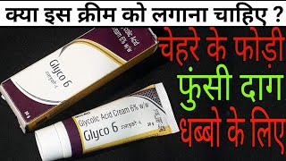 Glyco 6 Cream Review Hindi [upl. by Edrock]