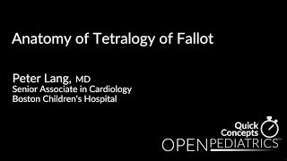 Anatomy of Tetralogy of Fallot by P Lang  OPENPediatrics [upl. by Hedley258]