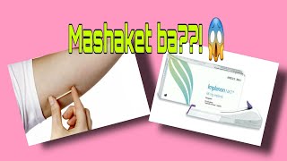 IMPLANON  Masakit ba  Effective kaya  RiJeAn implanon contraceptive implant [upl. by Aihsem]