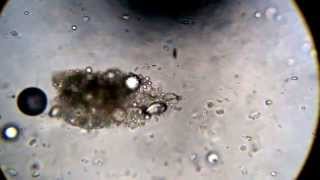 Microscope Sputum Analysis  Ciliated Cells Wiggly Wiggly [upl. by Yanehc]