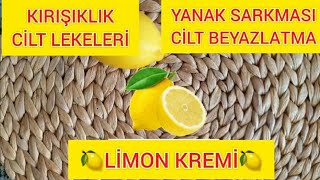 Kırışık Gideren Tüm Cilt Lekelerini Temizleyen Yanak Sarkmasını Toparlayan Beyazlatıcı Limon Kremi [upl. by Zebadiah]