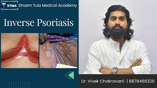 Inverse psoriasis  Psoriasis  Skin Disease  Skin psoriasis psoriasiscure psoriasissolution [upl. by Oskar508]