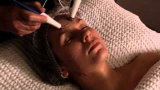 Non Surgical FacialImarni Cosmetic Therapies [upl. by Hazel431]