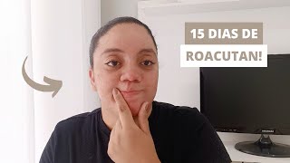 EFEITOS COLATERAIS DO MEU ORGANISMO TOMANDO ROACUTAN NOS 15 PRIMEIROS DIAS  CRISLANE MOTA [upl. by Hestia]