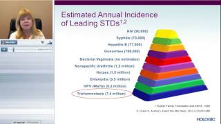 The Most Common STI Trichomonas Vaginalis TV [upl. by Aronson]