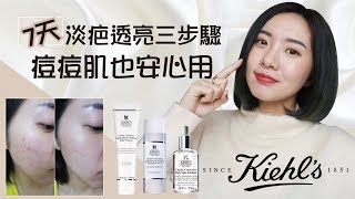 痘痘肌7天有感淡疤三步驟│KIEHLS激光極淨白系列新產品│BeautYuhan [upl. by Eixor661]