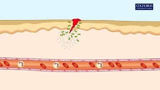 Animation 241 Inflammatory response [upl. by Koby814]