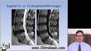 Dr Gillard lectures on How to Read Your Lumbar MRI [upl. by Rudolph]