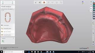 Webinar 3D Printing Digital Dentures with Dentca Resins – Part 2 with Cory Lambertson [upl. by Nerag]