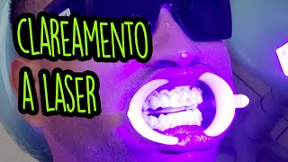 Como é o CLAREAMENTO dental a LASER [upl. by Karilynn]