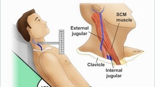 Jugular Venous Distention Explained clearly PART A Jugular venous pressure Waveform [upl. by Stannwood]