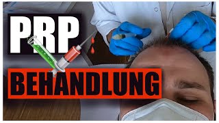 PRP Behandlung Eigenbluttherapie  Erfahrungsbericht  Mini Vlog [upl. by Nnaihs22]