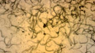 Aelurostrongylus abstrusus L1 Larvae after Baermann Method Examination  Domestic Cat  2014 [upl. by Lapides150]