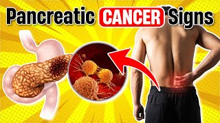 Early Warning Signs of Pancreatic Cancer You Shouldnt Ignore [upl. by Aicilra456]