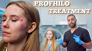 Profhilo Treatment  Dermal Filler For Fine Lines amp Wrinkles  Dr Somji amp Dr Solomon Demonstrate [upl. by Ainitsirc]