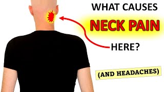 What Causes Upper Neck Pain And Headaches [upl. by Mendy]