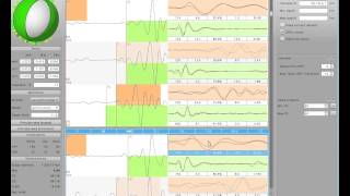 Demonstration of scmtv [upl. by Eednil]