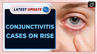 Conjunctivitis Cases on Rise  Latest update  Drishti IAS English [upl. by Trebbor675]