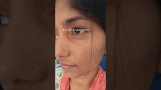 Best acne treatment skintreatment acnetreatment pimple pimplefreeskin skincare shortvideo [upl. by Greg]