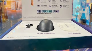 Eversense The 180day Implantable CGM  CEO Interview [upl. by Ynehteb]